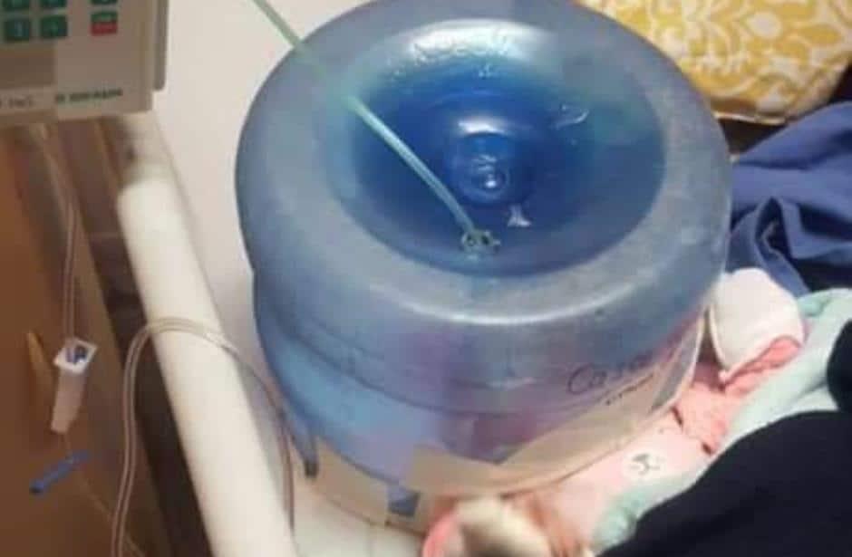 Usan un garrafón como incubadora en hospital