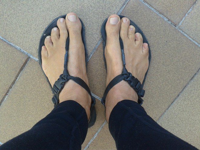 Uso de sandalias afecta tus rodillas y otras partes del cuerpo
