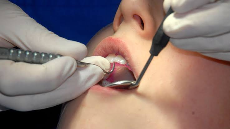 Mujer acude al dentista para tratamiento y fallece desangrada