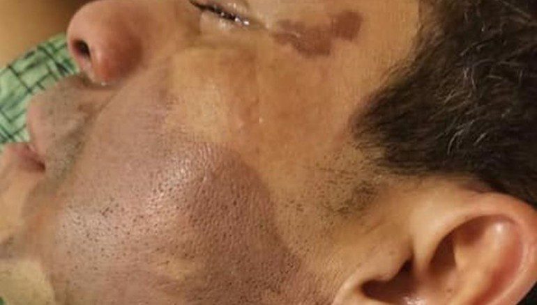 Lanzan ácido en la cara de un latino en EU (VIDEO)