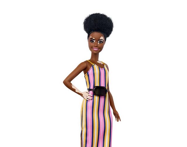 Mattel presenta la nueva BARBIE VITILIGO