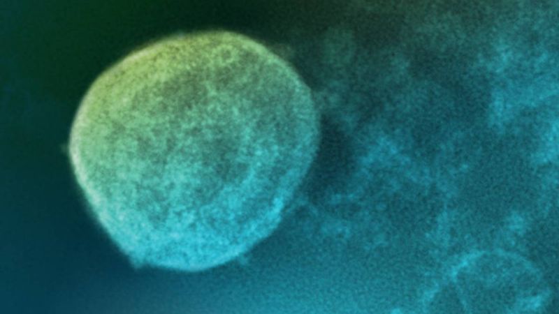 Alertan sobre el “Nipah” el nuevo virus con potencial pandémico