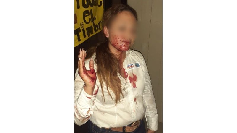 Hombre de la tercera golpea en el rostro a candidata a regidora en SLP