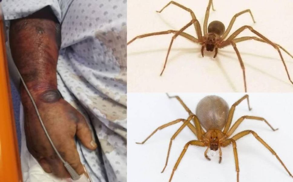 Muere hombre por picadura de araña violinista en Guanajuato