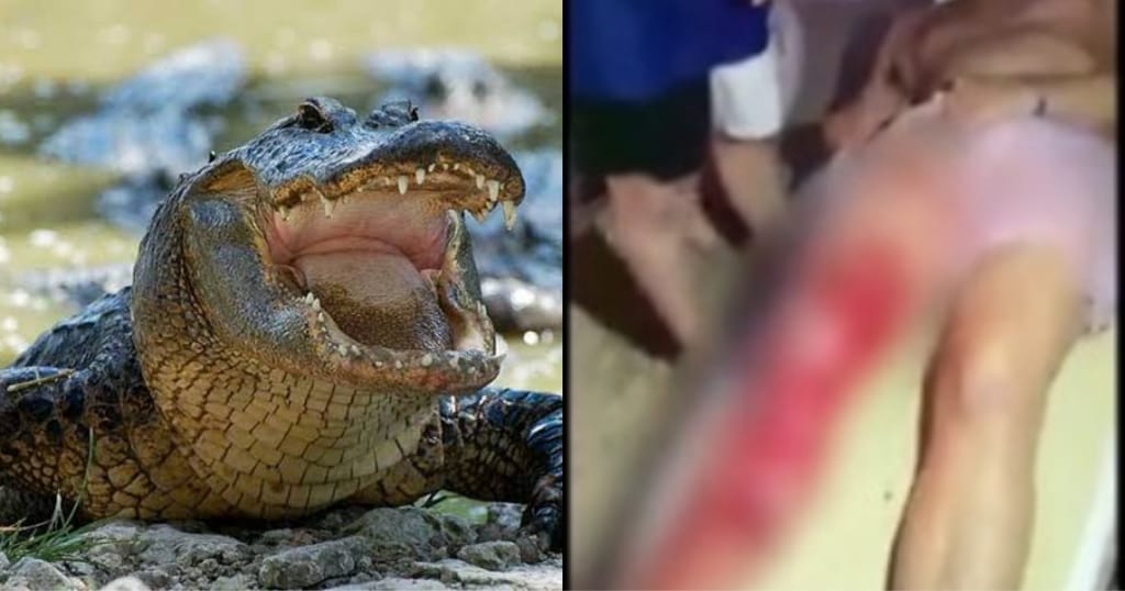 Cocodrilo ATACÓ a un turista estadunidense en Nuevo Vallarta