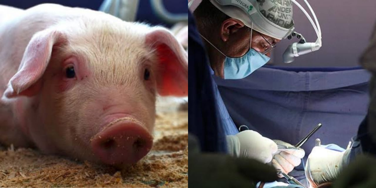 ¡Todo un éxito! Realizan el primer trasplante de riñón de cerdo a paciente humano