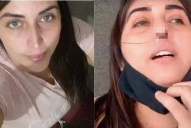Mujer asegura que prueba COVID le DESTROZÓ el cartílago de la nariz