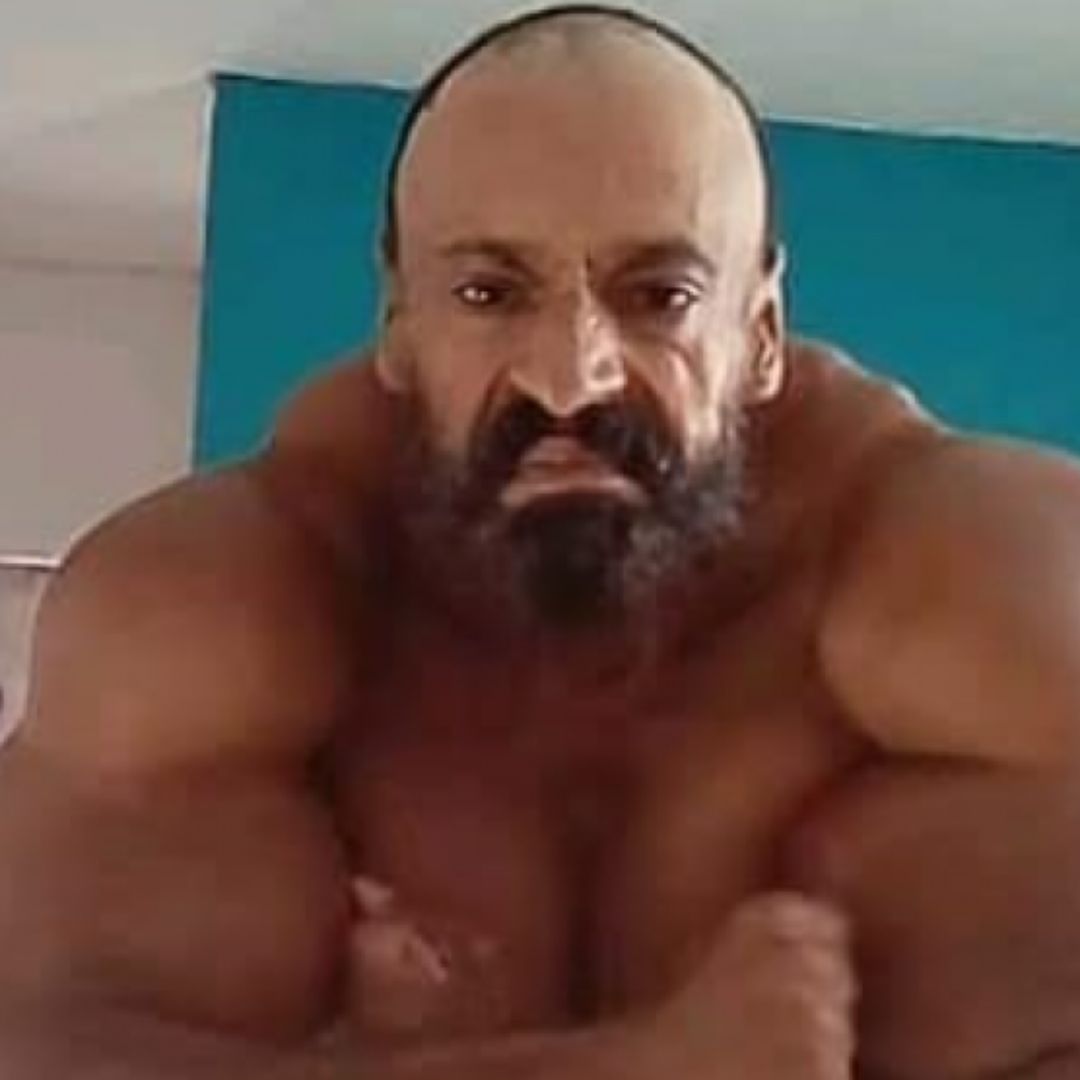 Muere fisicoculturista tras inyectarse Synthol para aumentar músculos