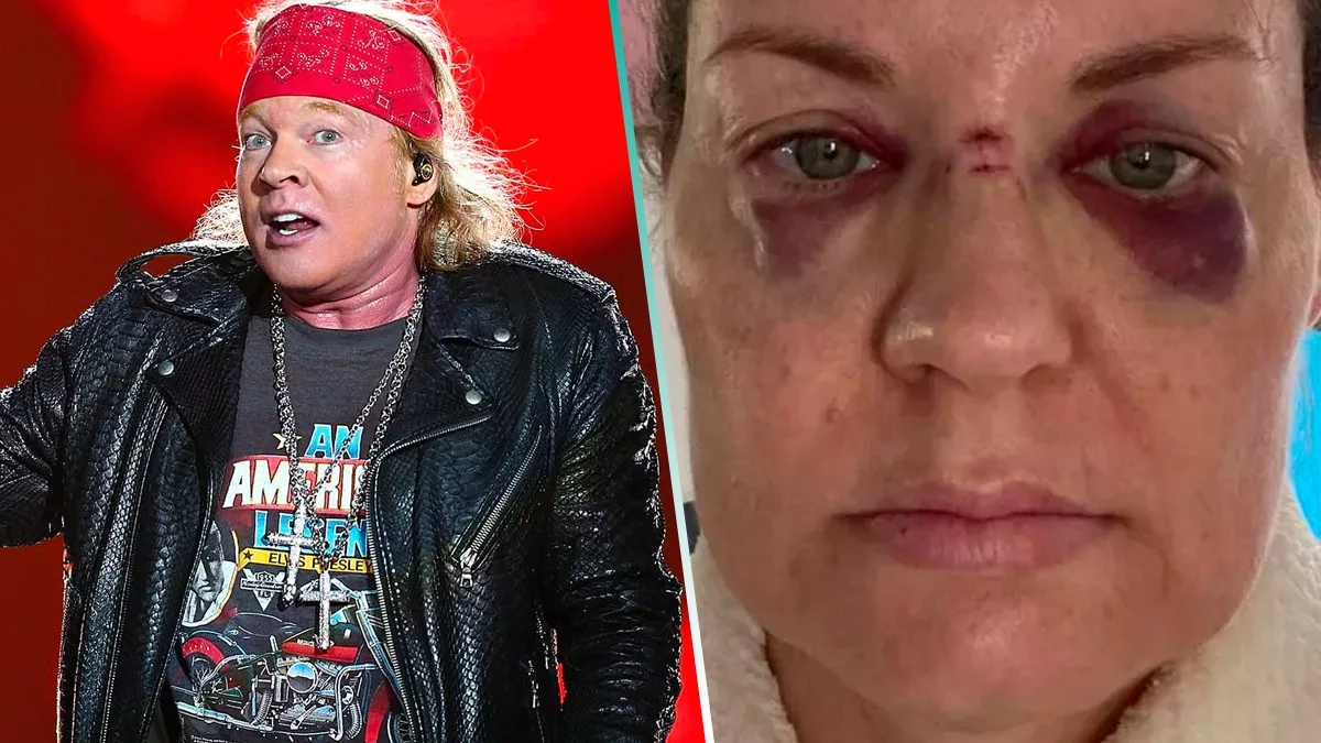 Axl Rose lanza micrófono en concierto y golpea a fan