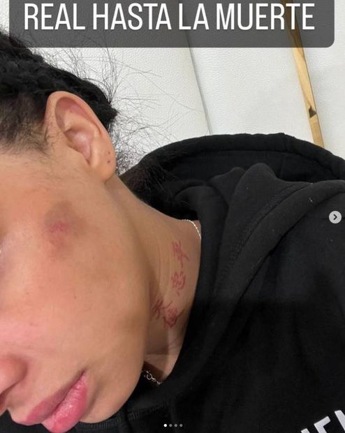 Yailin golpeada