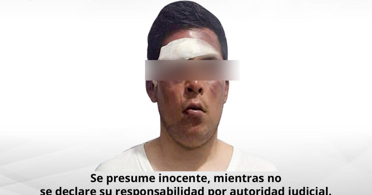 Dan imputación contra masculino que disparó a policía vial de Cuautla
