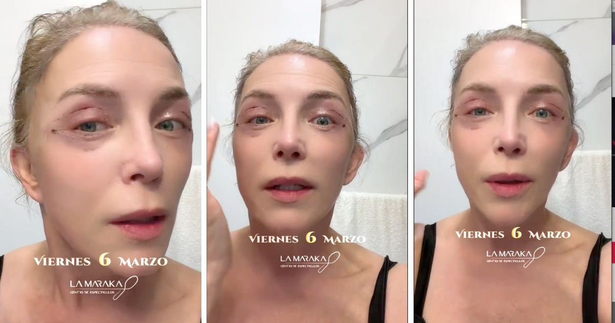 laura flores blefaroplastia