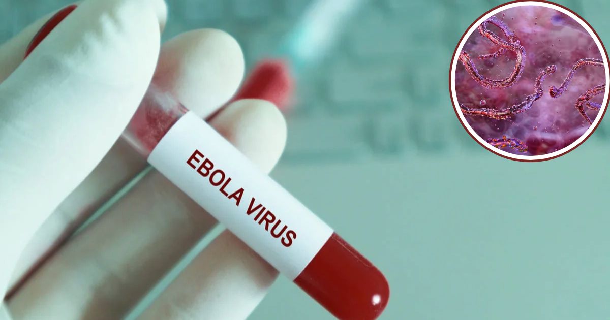 Virus Ébola