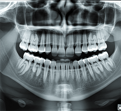 radiografías odontológicas
